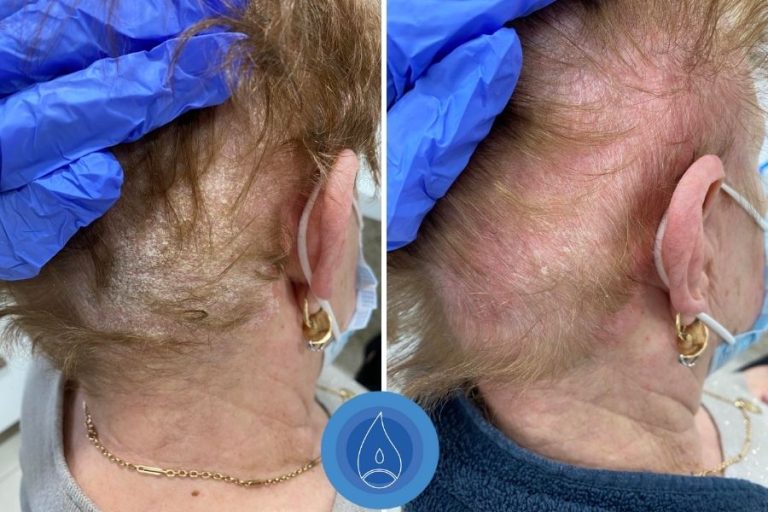 Oxigenterapia eredmenyek (80)